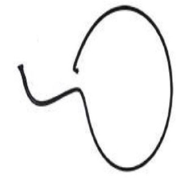  | TUBO COMBUSTIVEL FILTRO AO MOTOR VW/CARGO