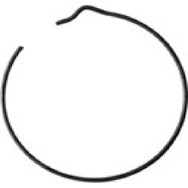  | ANEL TRAVA ROLAMENTO PINHAO MB 1113/1313 - ARAME