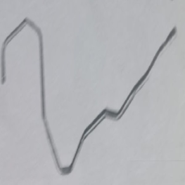  | TUBO RADIADOR OLEO CAIXA CAMBIO VOLVO FH/NH