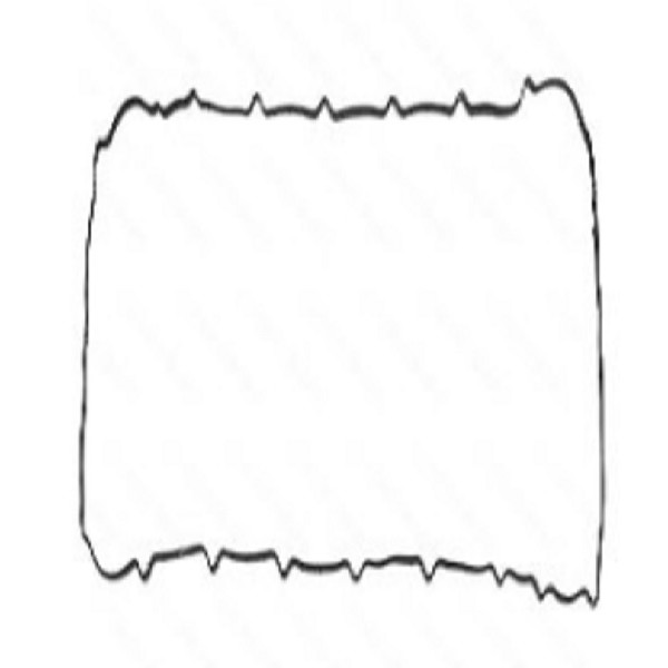  | JUNTA TAMPA VALVULA STRALIS/EUROTRACKER/CURSOR 12/.